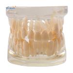 Orthodontic Dental Study Models Tooth Teaching , Dental Models For Patient