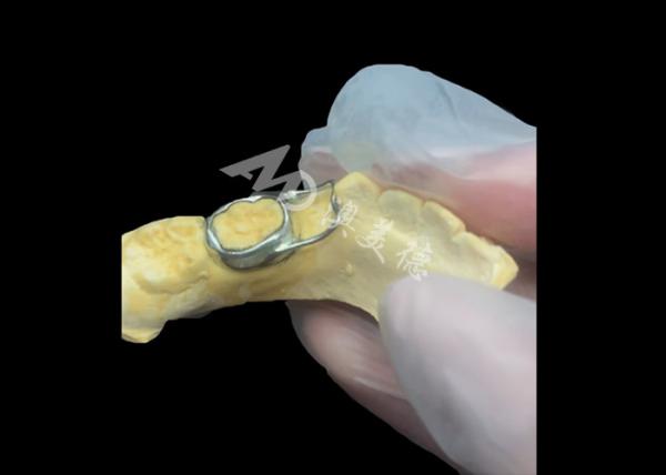 Orthodontic Space maintainer an invaluable device ingeniously guarding children