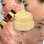 Buy cheap Organic Skin Care Acne Wrinkle Dark Spot Moisturizer Bleaching Turmeric Face Cream from wholesalers