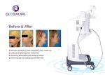 Ultrasound Face Lifting HIFU Machine 25000 Shots Self Developed Patent