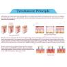 Buy cheap Factory price elight hair removal skin rejuvenation beauty salon equipment ipl shr with fda ce from wholesalers