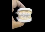 Prosthetic Dentistry Zirconia Dental Crown Precise Fit Aesthetics For full arch