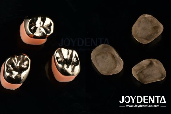Buy cheap Dental Restoration Gold Metal Crowns for Oral Rehabilitation Treatment from wholesalers