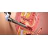 Buy cheap F7+ 30W RF Tube co2 fractional Laser vaginal tighten and skin rejuvenation machine from wholesalers