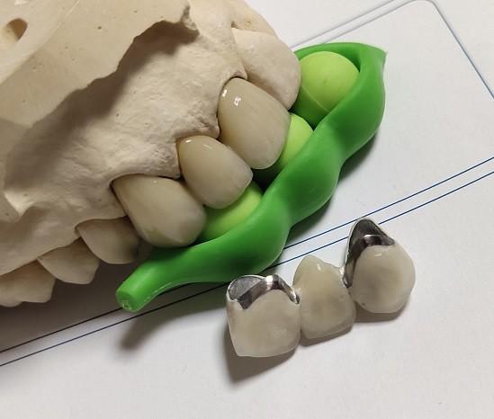 Buy cheap Porcelain CAD CAM PFM Crown from wholesalers