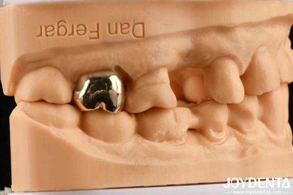 Buy cheap Abrasion Resistant Wax Casting Dental Materials for Enhanced Oral Rehabilitation from wholesalers
