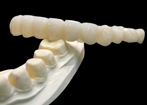 Buy cheap Vita Classical Shade All Ceramic Crown Bridge Natural Looking For Dental Restoration from wholesalers