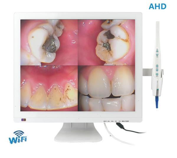 Buy cheap Wireless Wifi Dental Digital Mouthwatch Intraoral Camera 17 Inch LED Monitor from wholesalers
