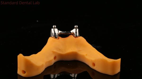 Buy cheap Ivoclar Digital Dental Implant Bar Denture with Attachments , Full Acrylic Titanium Implant Supported Dentures from wholesalers