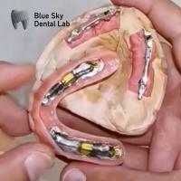 Buy cheap Blue Sky Dental Implants With Titanium Bar For Removable Prosthesis product
