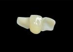 Chipping Resistance Zirconia dental Crown With Exceptional Strength And