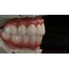 Buy cheap High Quality Dental zirconia crown and All On Four Six Implant Full Arch / China dental lab Manufacturer from wholesalers