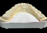 Natural Wear Resistant Ceramic Dental Crown Bridge For Lifelike Restoration