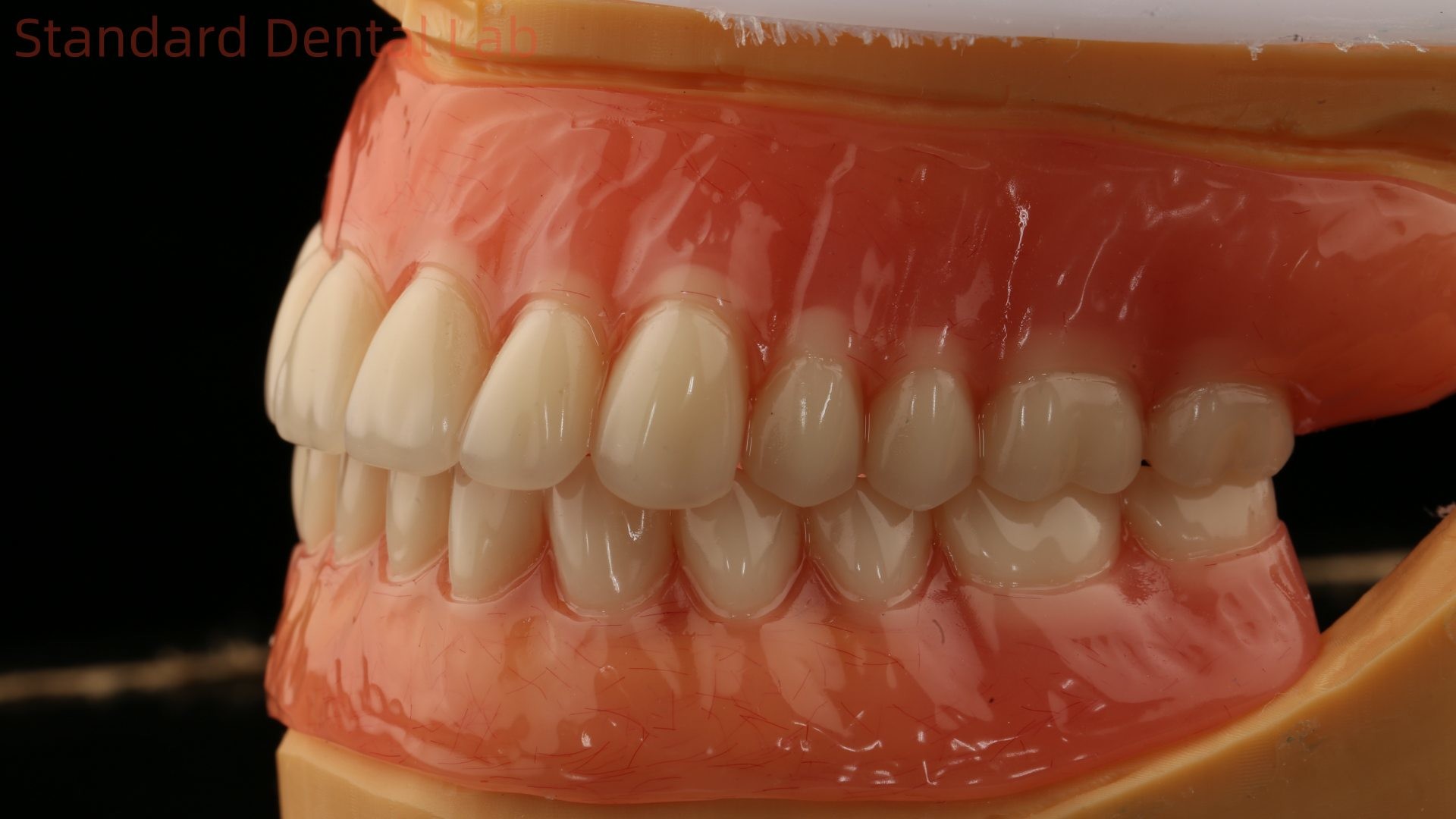 Heat Cured Ivoclar Full Acrylic Denture Dental Lab High Accuracy High Esthetic Advantage