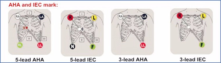 T5 / T8 ECG Cables And Leadwires Compatible Mindray Patient BeneView