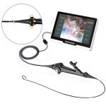 Flexible Video Ureteroscope Urological