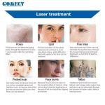 532nm 1064nm 1320nm Three Laser Tips Treatment