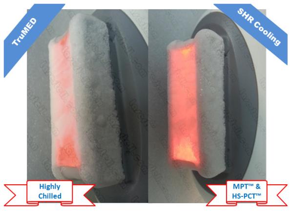Quality CE IPL Laser Equipment Hair Removel E Light For Upper Lip / Underarm / Face for sale