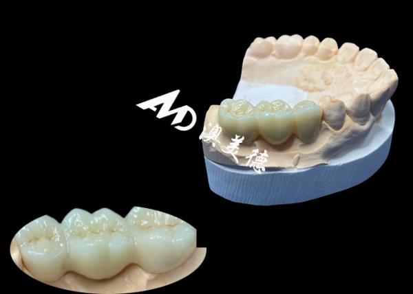 Buy cheap Natural Color Zirconia Dental Crown Crack Resistant For A Flawless Smile from China Dental Lab from wholesalers