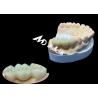 Buy cheap Natural Color Zirconia Dental Crown Crack Resistant For A Flawless Smile from China Dental Lab from wholesalers