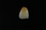 Buy cheap ADS Dental Lab Dental Veneer Zirconia Stain Lifelike Finish OEM from wholesalers
