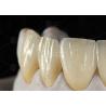 Buy cheap 0.3mm-0.7mm Feldspathic EMAX Ceramic Veneers Natural Aesthetic Emax Dental Veneers from wholesalers