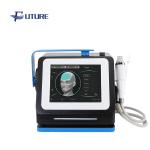 ISO Approval Microneedle Rf Treatment 0.3mm Needle Size Scars Removal
