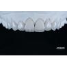 Buy cheap Natural Looking Emax Porcelain Veneer Comfortable Fit Ultra Thin Emax Veneers from wholesalers