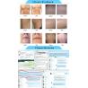 Buy cheap China nubway best popular medical ce approved portable 808 nm diode laser hair removal machine from wholesalers
