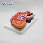 Enlarged Kidney Human Anatomical Model 1 Part Medical Life Size