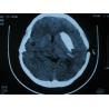 Buy cheap Konida Dry Imaging Film , Medical Paper Laser Imaging Film from wholesalers