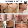Buy cheap Ultrasound Hifu Facial Machine 4D Portable Skin Tightening for Beauty Salon from wholesalers