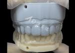 Orthodontic retainer　Essix Retainer Simple And Versatile Correction