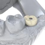 Dental Crown Restoration Permanent Crown Resin For Dental Crowns Volume 1000 Ml