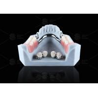 Buy cheap Titanium Dental Implant Ball Attachments Comfortable Secure Denture Retention product