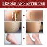 Buy cheap OEM ODM Hand And Foot Care Cream Anti Cracking Dry Peeling Repairing Cracks from wholesalers