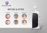 Opt Shr Elight Medical Laser Hair Removal Machines 10.4 Inch Color Touch Screen