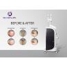 Buy cheap Opt Shr Elight Medical Laser Hair Removal Machines 10.4 Inch Color Touch Screen from wholesalers