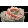 Buy cheap High Quality Dental zirconia crown and All On Four Six Implant Full Arch / China dental lab Manufacturer from wholesalers