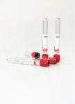 Meisi Clot Activator Tubes In Protein Electrophoresis