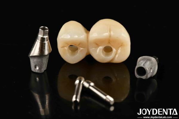 Buy cheap Accurate Fit Implant-Supported Crown Bridge System With Resistance To Stains And Discoloration from wholesalers