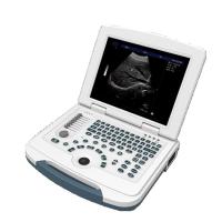 Buy cheap Multilingual USB Port Color Doppler Ultrasound Scanner product