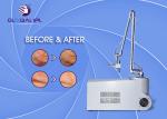 Air Cooling Fractional Co2 Laser Treatment / Scar Removal Machine Long Lifetime