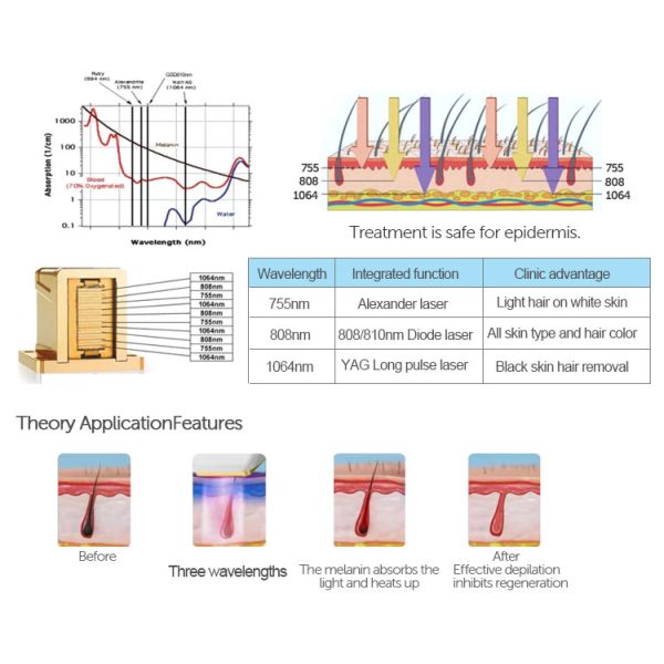 German Pump Diode Laser 808 Hair Removal 808nm Beauty Equipment Machine