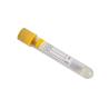 Buy cheap Yellow Clot Activator Gel Separator 9ml 10ml Serum Gel Clot Activator Tube from wholesalers