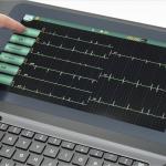 Factory Price 12 Channel Wifi Ecg Machine For Icu Hospital
