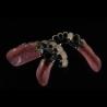 Buy cheap Aesthetic Precision Dental Implant Ball Attachment Partial Dentures from wholesalers