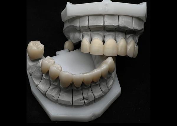 Buy cheap Resistance Chipping Dental Zirconia Crown For Single Or Multiple Teeth from wholesalers