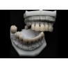 Buy cheap Resistance Chipping Dental Zirconia Crown For Single Or Multiple Teeth from wholesalers