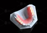 Orange Pink Acrylic Partial Denture Natural Looking 3d Printing Digital Dentures
